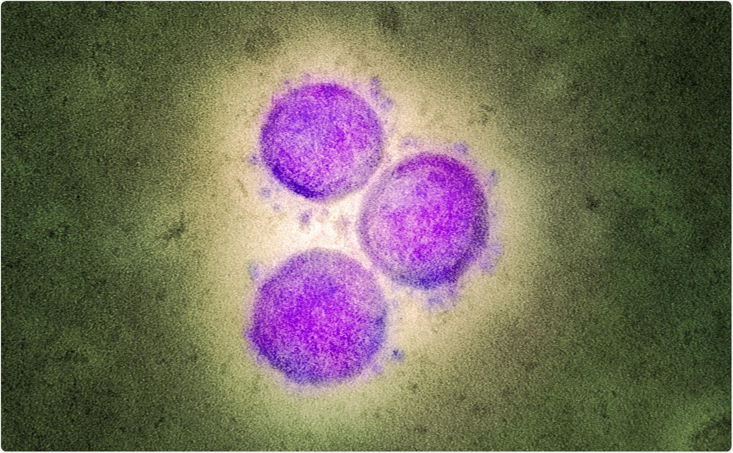 Transmission electron micrograph of SARS-CoV-2 virus particles. Image Credit: NIAID