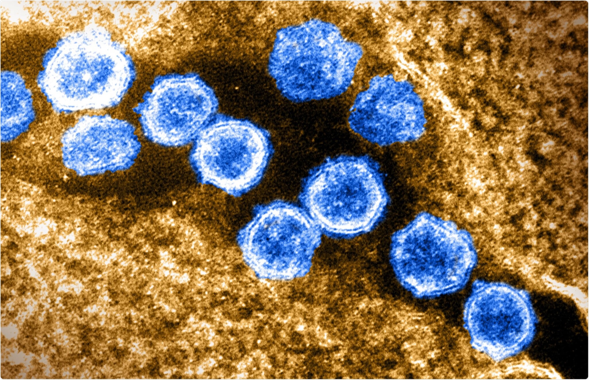 Study: Immunogenicity of COVID-19 Vaccination in Immunocompromised Patients: An Observational, Prospective Cohort Study Interim Analysis. Image Credit: NIAID