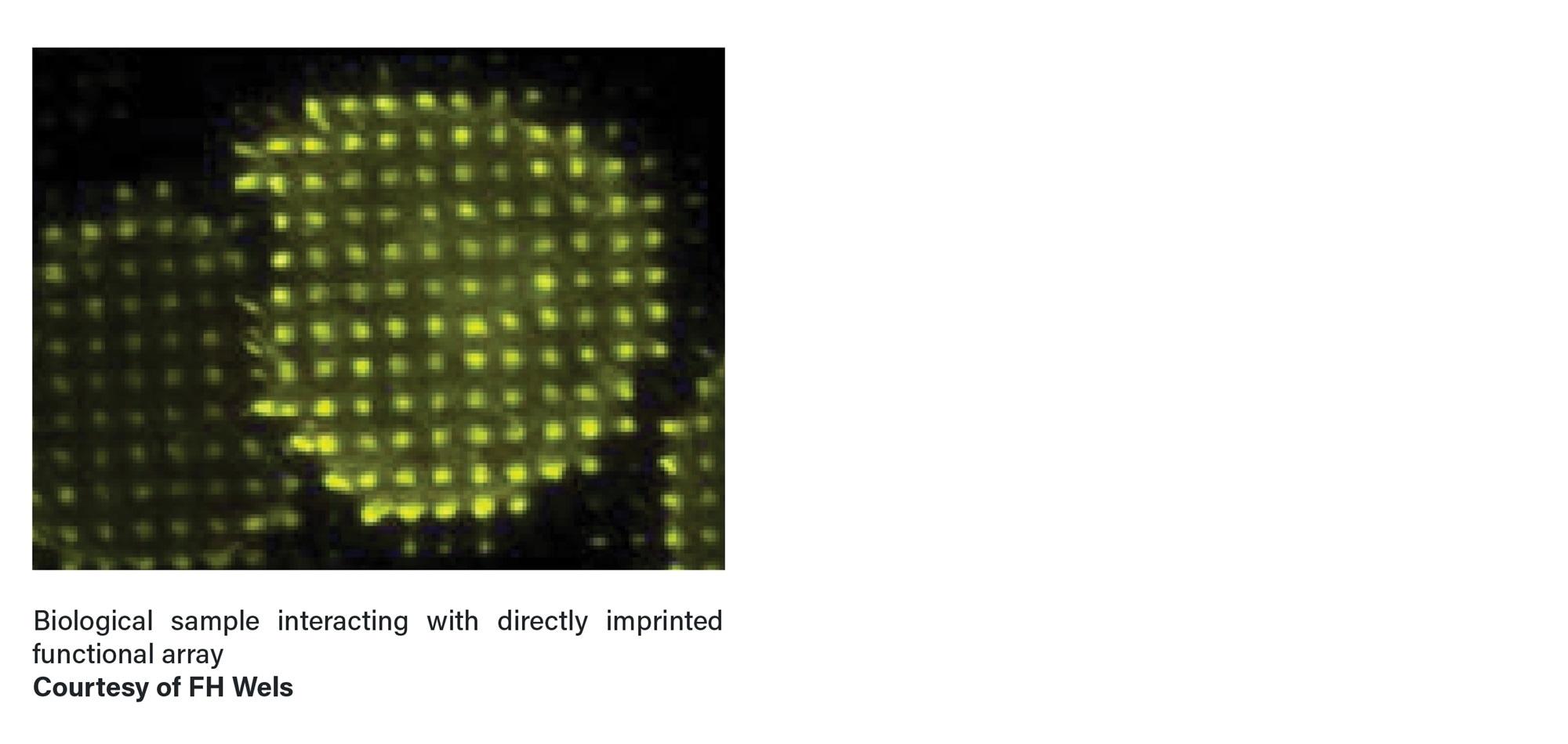 Nanoimprint Lithography: Bio and Medical Technology