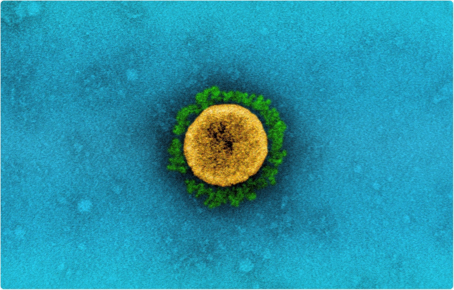 Study: SARS-CoV-2 Lambda Variant Remains Susceptible to Neutralization by mRNA Vaccine-elicited Antibodies and Convalescent Serum. Image Credit: NIAID