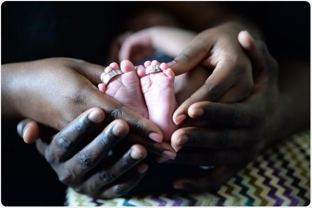 Survival for babies born with congenital anomalies depends on place of birth