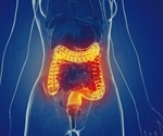 Ultra-processed foods increase the risk of inflammatory bowel disease