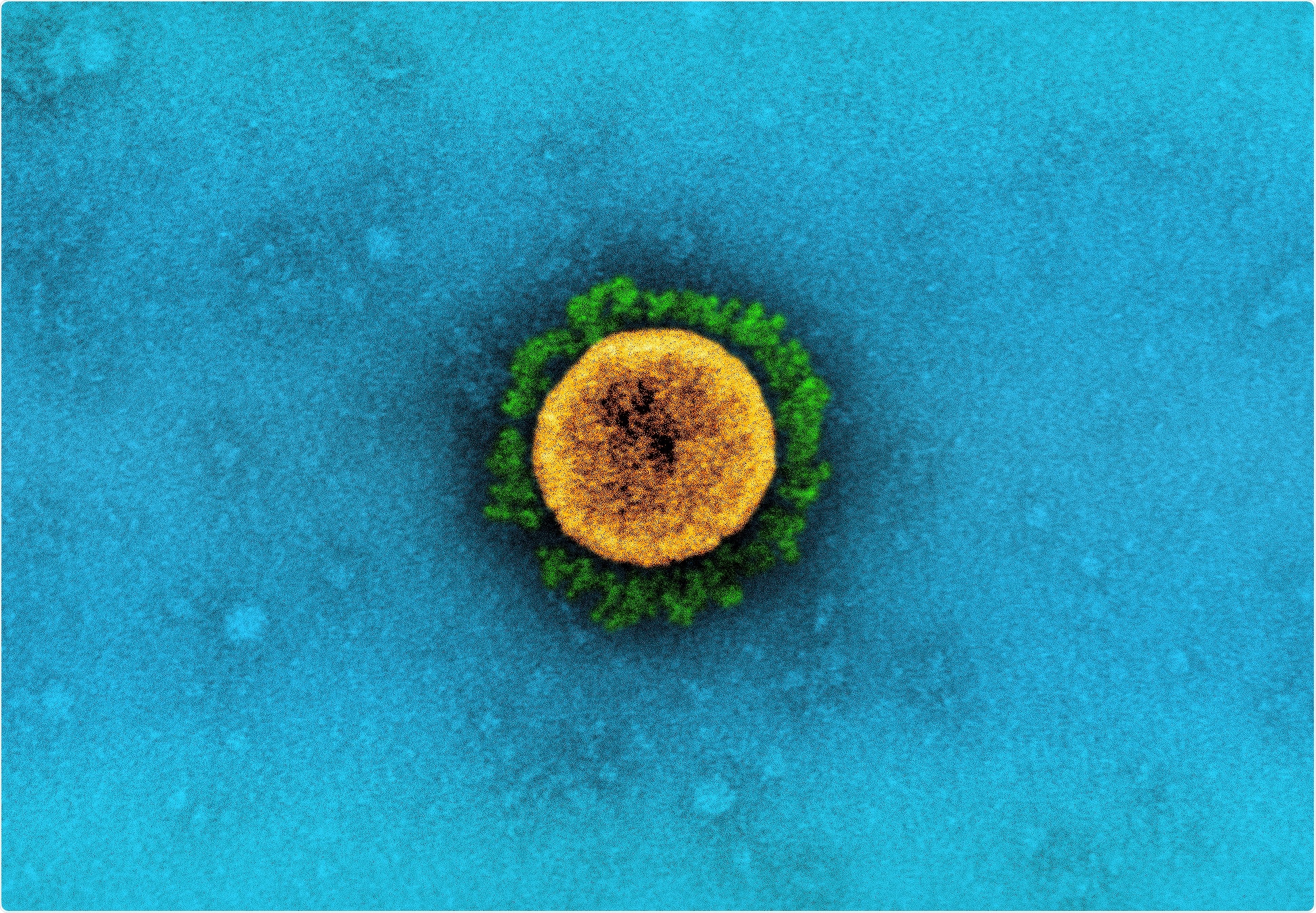 Study: Epidemiological characteristics of the B.1.526 SARS-CoV-2 variant. Image Credit: NIAID