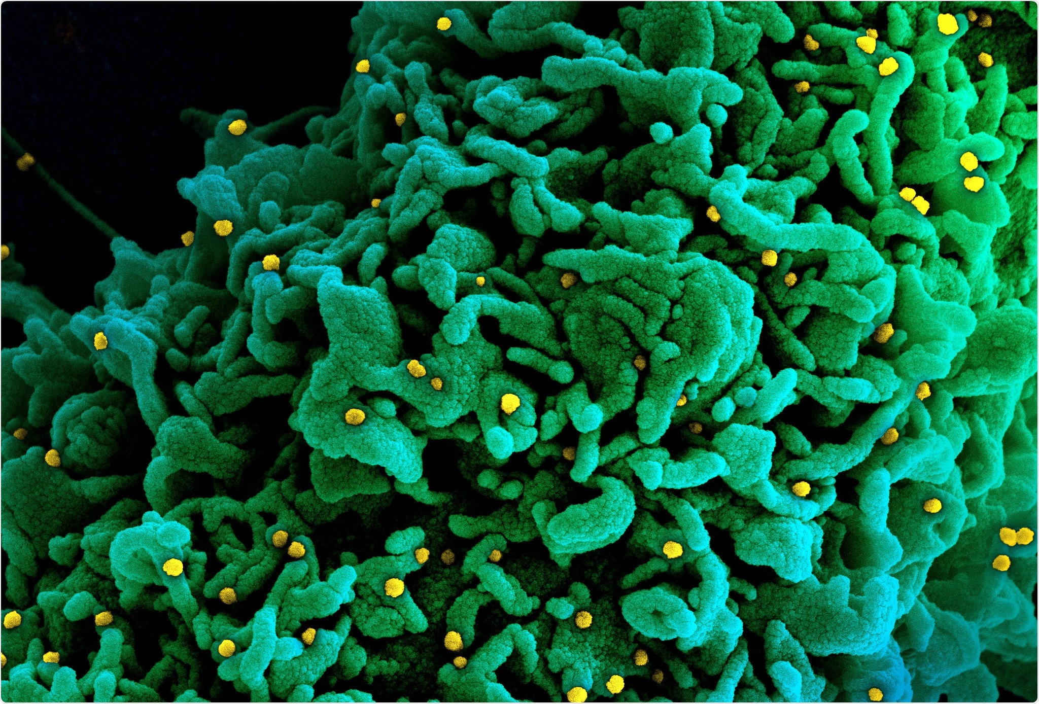 Study: Spike protein multiorgan tropism suppressed by antibodies targeting SARS-CoV-2. Image Credit: NIAID