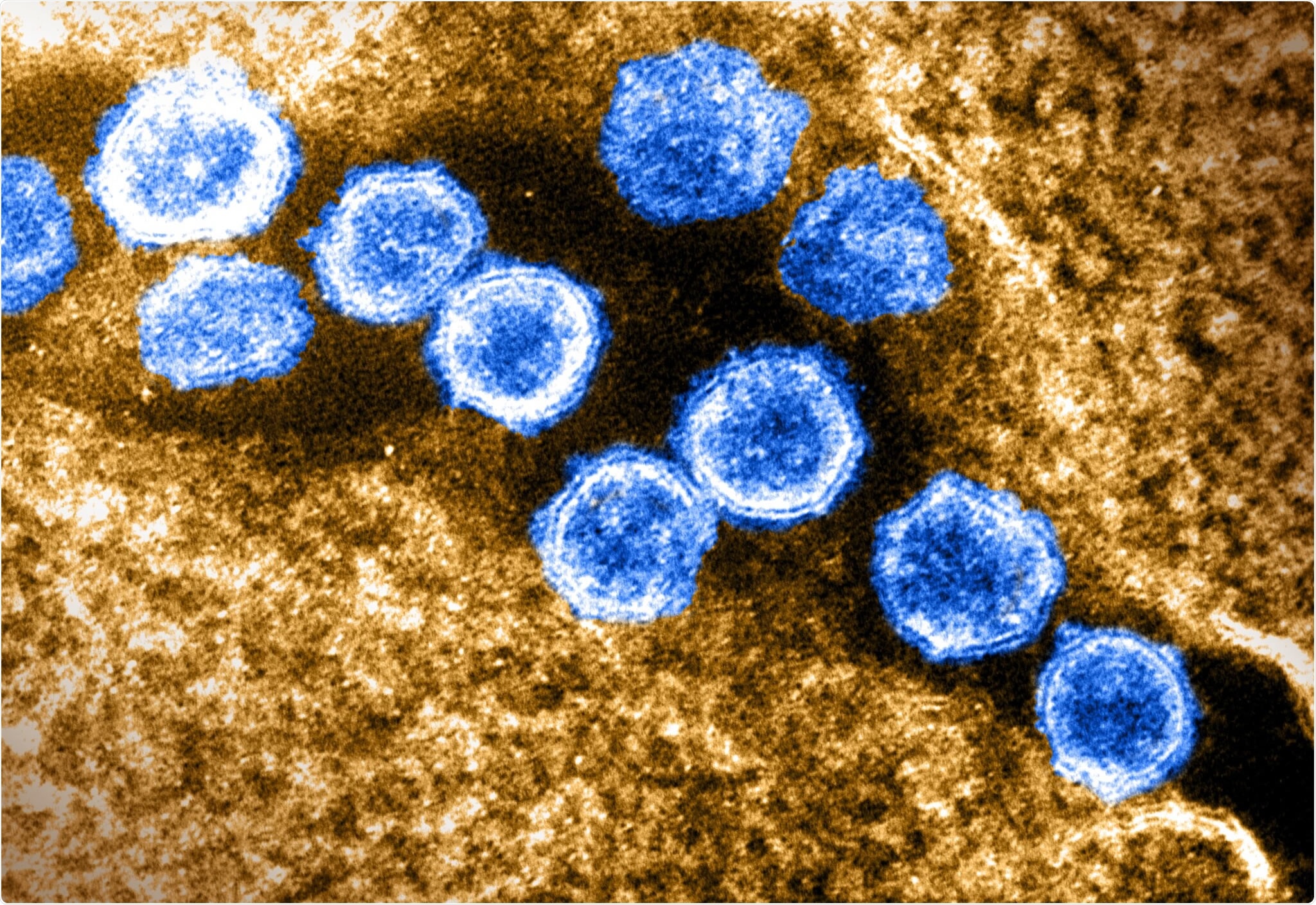 This transmission electron microscope image shows SARS-CoV-2—also known as 2019-nCoV, the virus that causes COVID-19. Virus particles are shown emerging from the surface of a cell cultured in the lab. The spikes on the outer edge of the virus particles give coronaviruses their name, crown-like. Image captured and colorized at Rocky Mountain Laboratories in Hamilton, Montana. Credit: NIAID