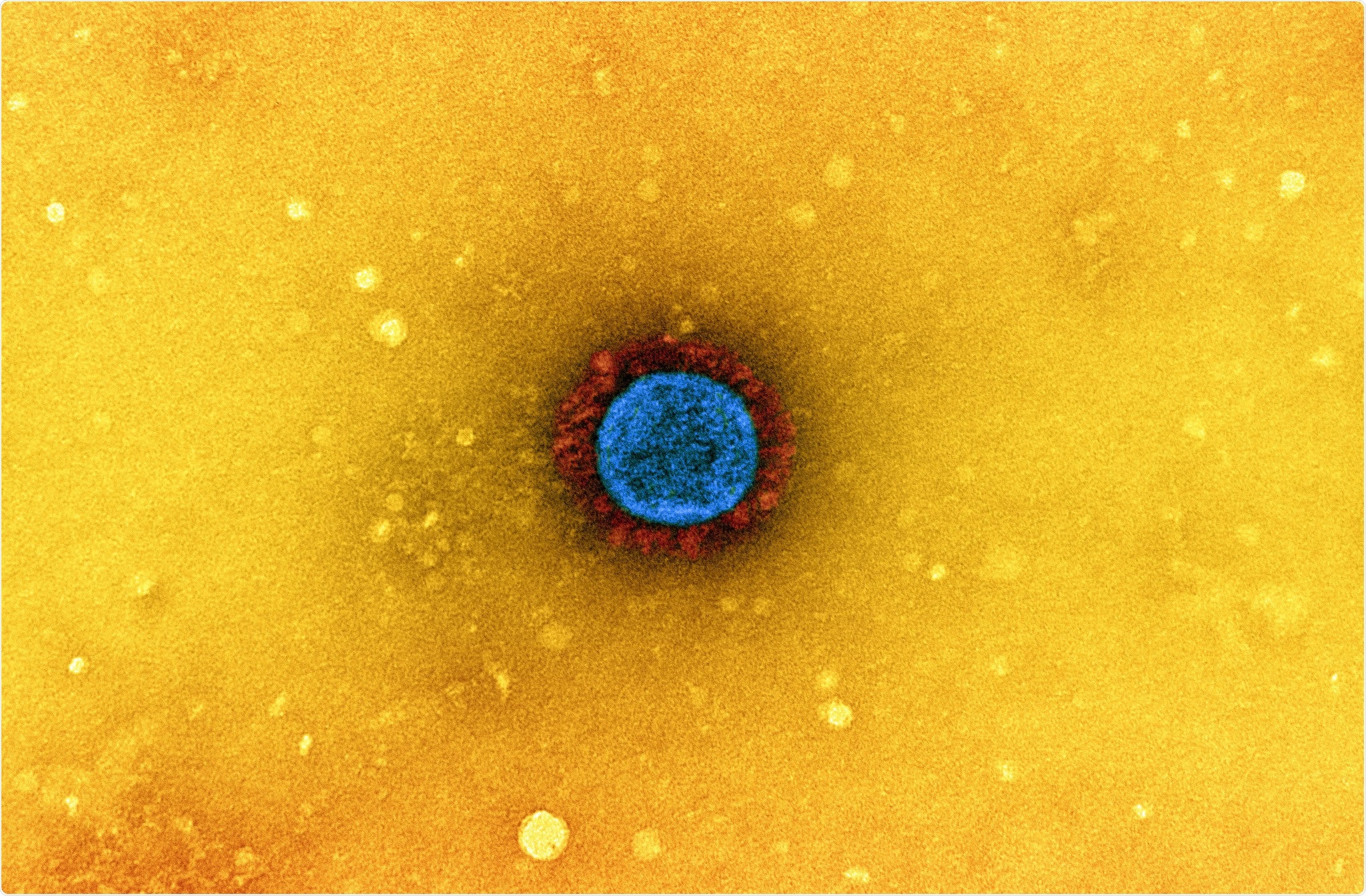 Study: Serum antibody response to BNT162b2 after natural SARS-CoV-2 infection. Image Credit: NIAID