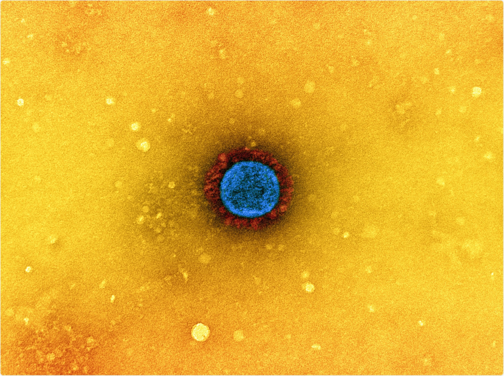 Study: Association of Naïve B Cells with Humoral Response to SARS-CoV-2 Vaccination. Image Credit: NIAID