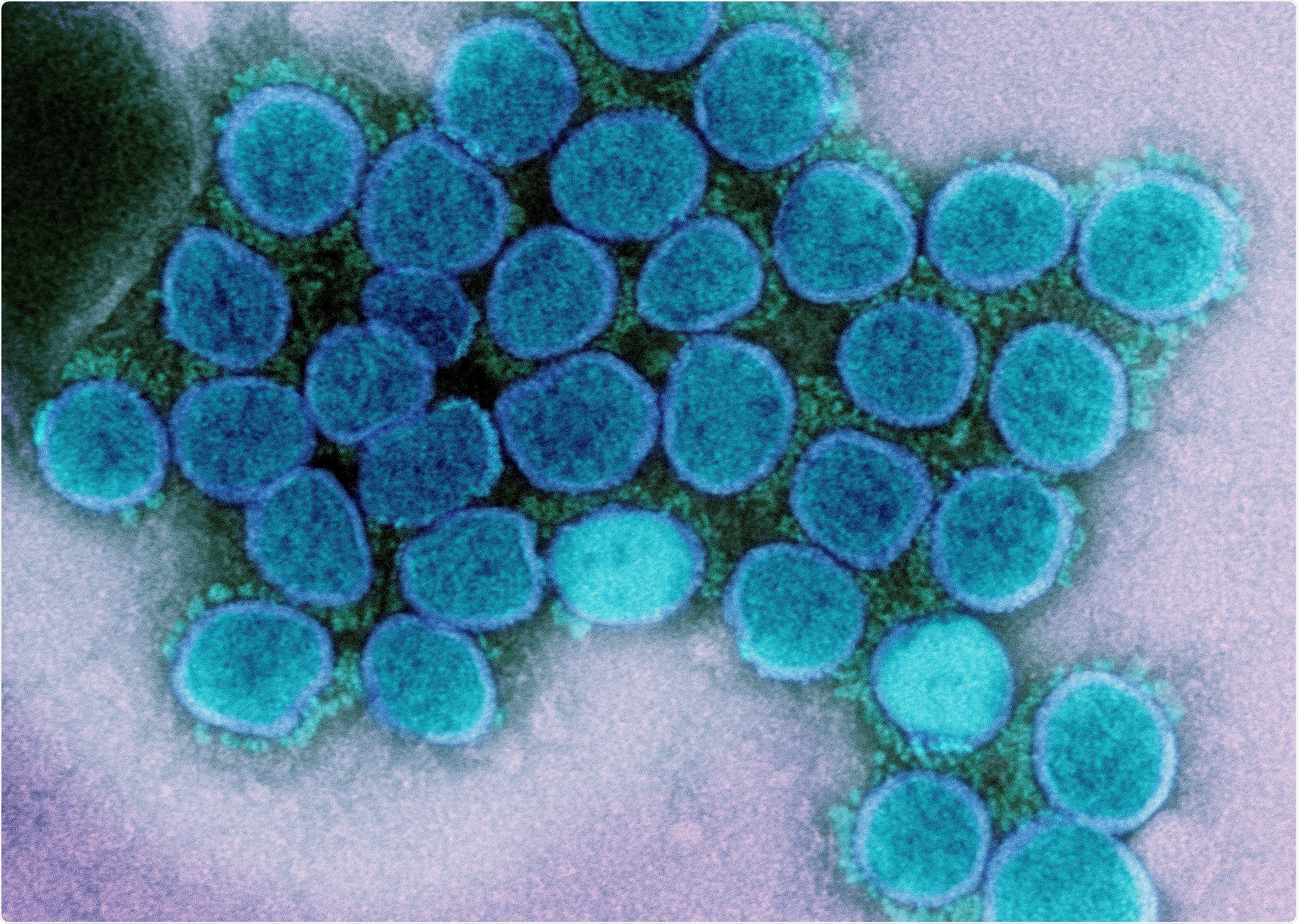 Study: Rapid assessment of SARS-CoV-2 evolved variants using virus-like particles. Image Credit: NIAID