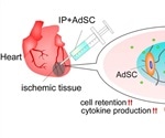 New stem-cell-carrying hydrogel could help the heart recover from myocardial ischemia