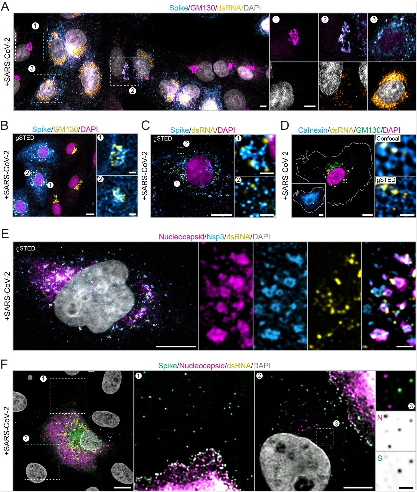 Nanoscopic visualization of the SARS-CoV-2 infection cycle in Vero E6 cells