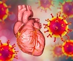 Risk of myocarditis from SARS-CoV-2 infection is higher in young males, a study finds
