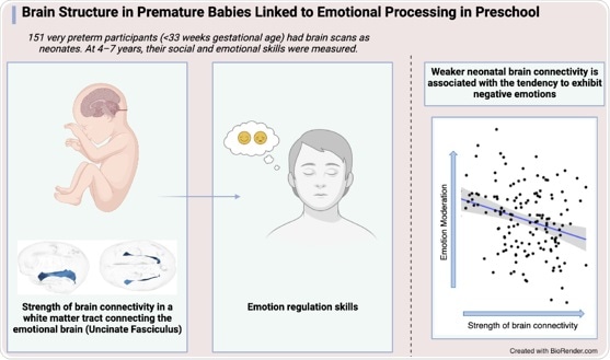 Strength of brain connections in premature infants may predict future emotional development