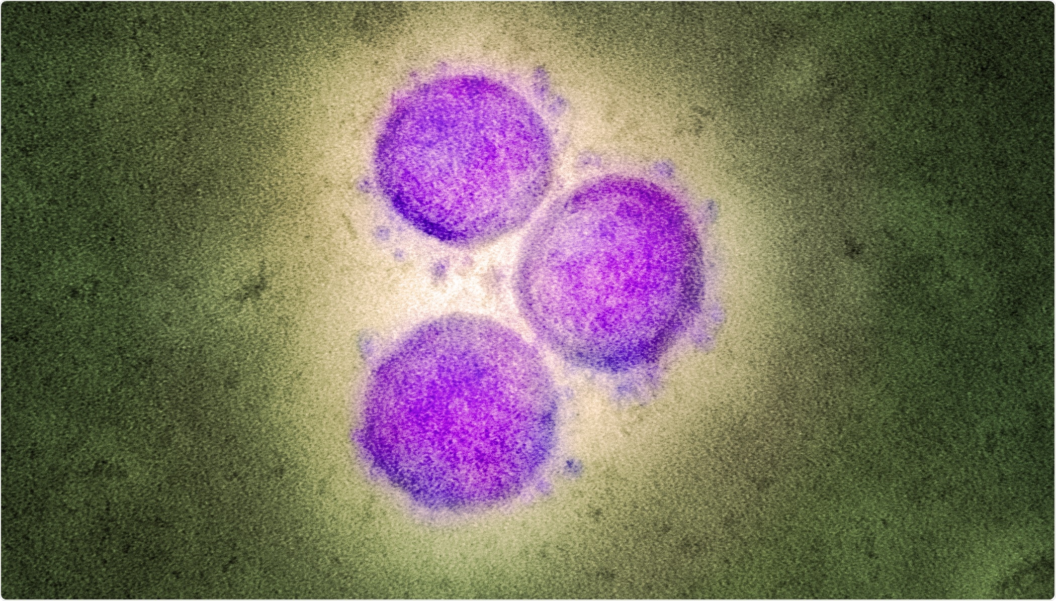 Estudio: El aumento con dependencia de los anticuerpos de la infección SARS-CoV-2 es mediado por los receptores FcγRIIA y FcγRIIIA de IgG pero no contribuye a la producción aberrante del Cytokine por los macrófagos. Haber de imagen: NIAID