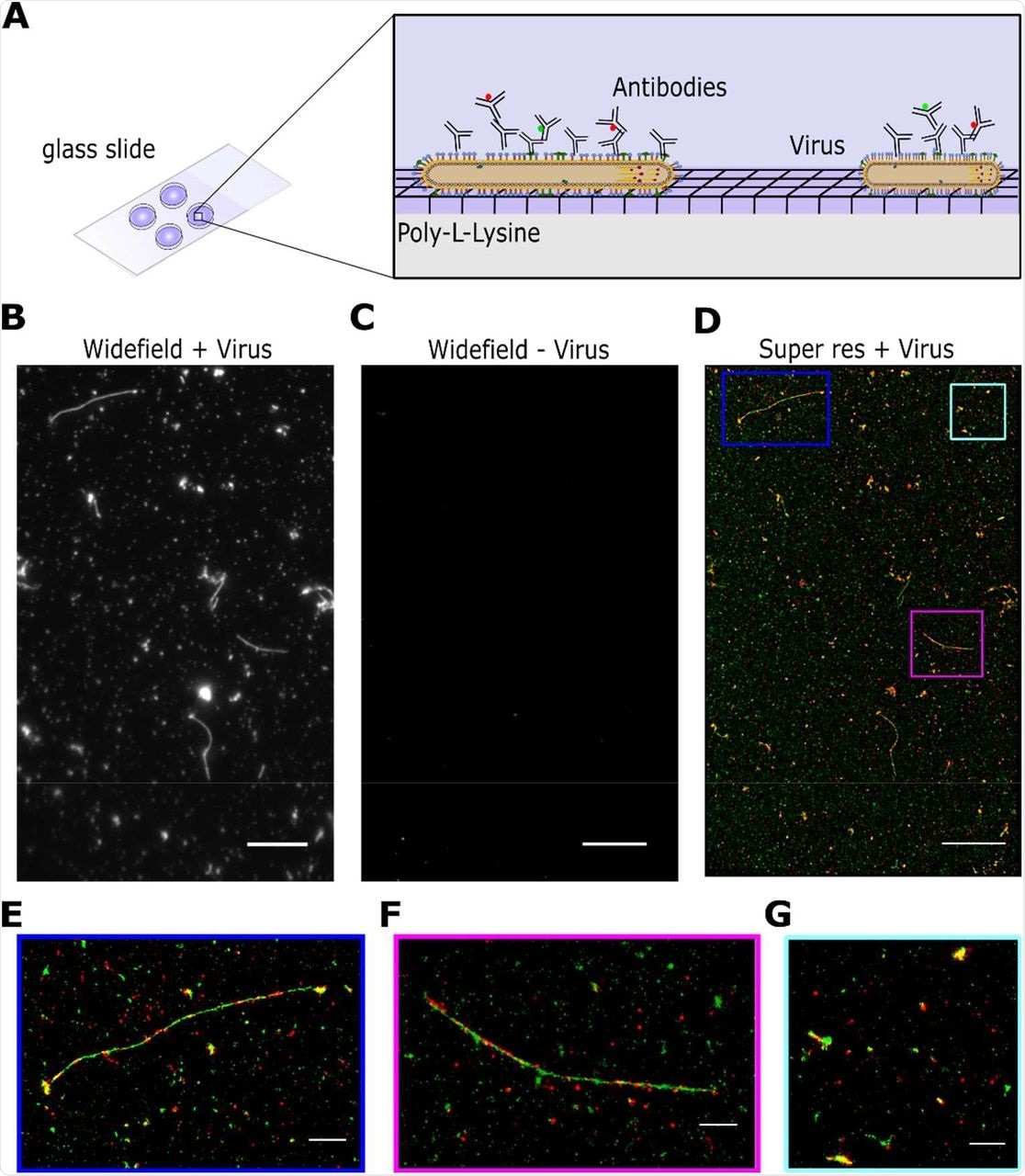 High throughput imaging of influenza using super-resolution microscopy A) Schematic of the labelling protocol. Virus samples were dried directly onto glass coverslips pre-coated with poly-L-lysine before being fixed, permeabilised and stained with antibodies using a standard immunofluorescence protocol. B) A representative field of view (FOV) of a widefield image of labelled A/Udorn/72 influenza, imaged in the green channel. Scale bar 10 μm. C) A representative FOV of a widefield image of a virus negative sample, imaged in the green channel. Scale bar 10 μm. D) The corresponding dSTORM image of the FOV in B), where HA is labelled in green and NA is labelled in red. Scale bar 10 μm. E-G) Zoomed in images from D) showing individual filaments and spherical particles. Scale bar 5 μm.