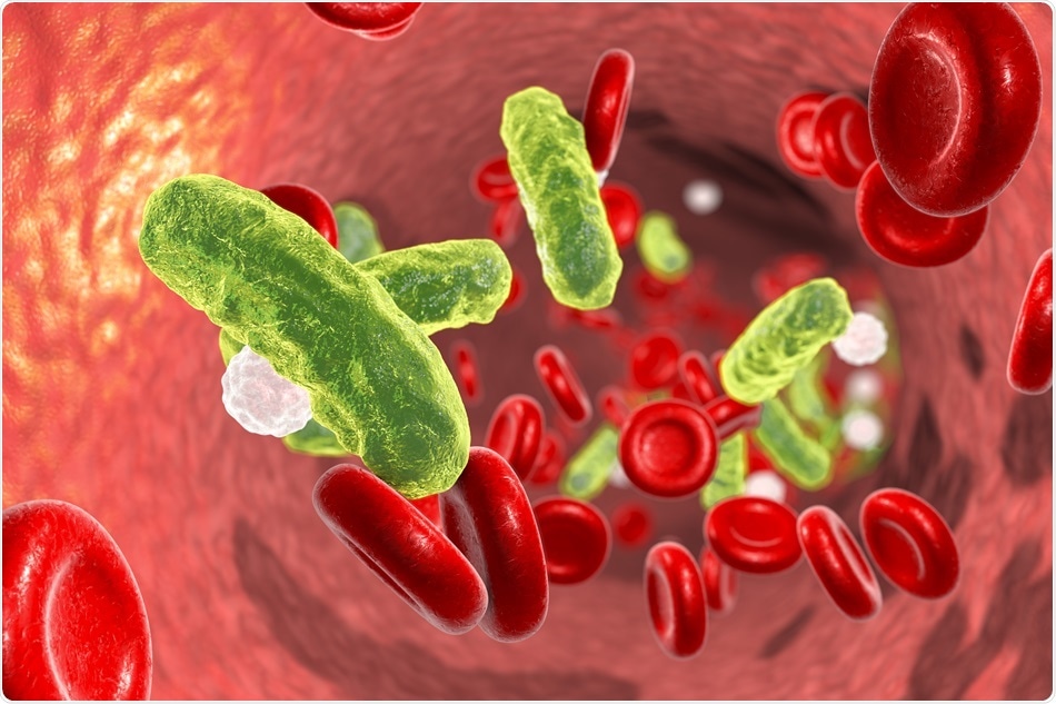 Study supports the implementation of Beckman Coulter’s MDW in emergency labs as initial test to detect sepsis