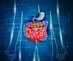 New imaging technique uses photonics for early diagnosis of bowel cancer