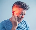 Severe tinnitus following SARS-CoV-2 infection