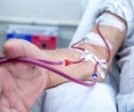 Maintenance dialysis patients may need additional shots of COVID-19 vaccines