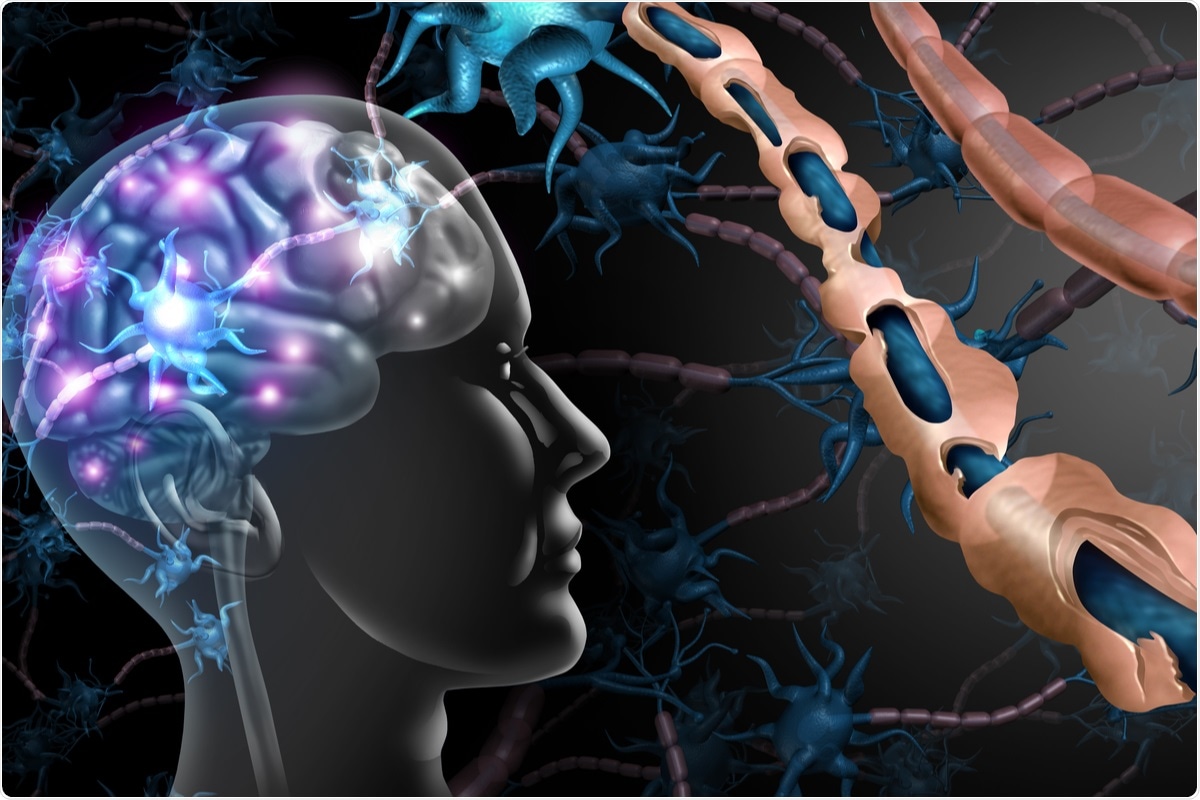 Study: Impact of multiple sclerosis disease-modifying therapies on SARS-CoV-2 vaccine-induced antibody and T cell immunity. Image Credit: Lightspring/ Shutterstock