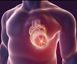 高敏感性肌钙蛋白与心脏病发作之间的联系