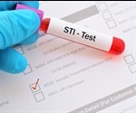 COVID-19 and Sexually Transmitted Infections