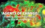 Tracking Tumor Progression by Glycan Imaging Mass Spectrometry - Prof. Richard Drake