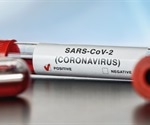 Research shows a relationship between increased SARS-CoV-2 seroreactivity and antimalarial humoral immunity