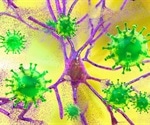 SARS-CoV-2 activates microglia in the brain