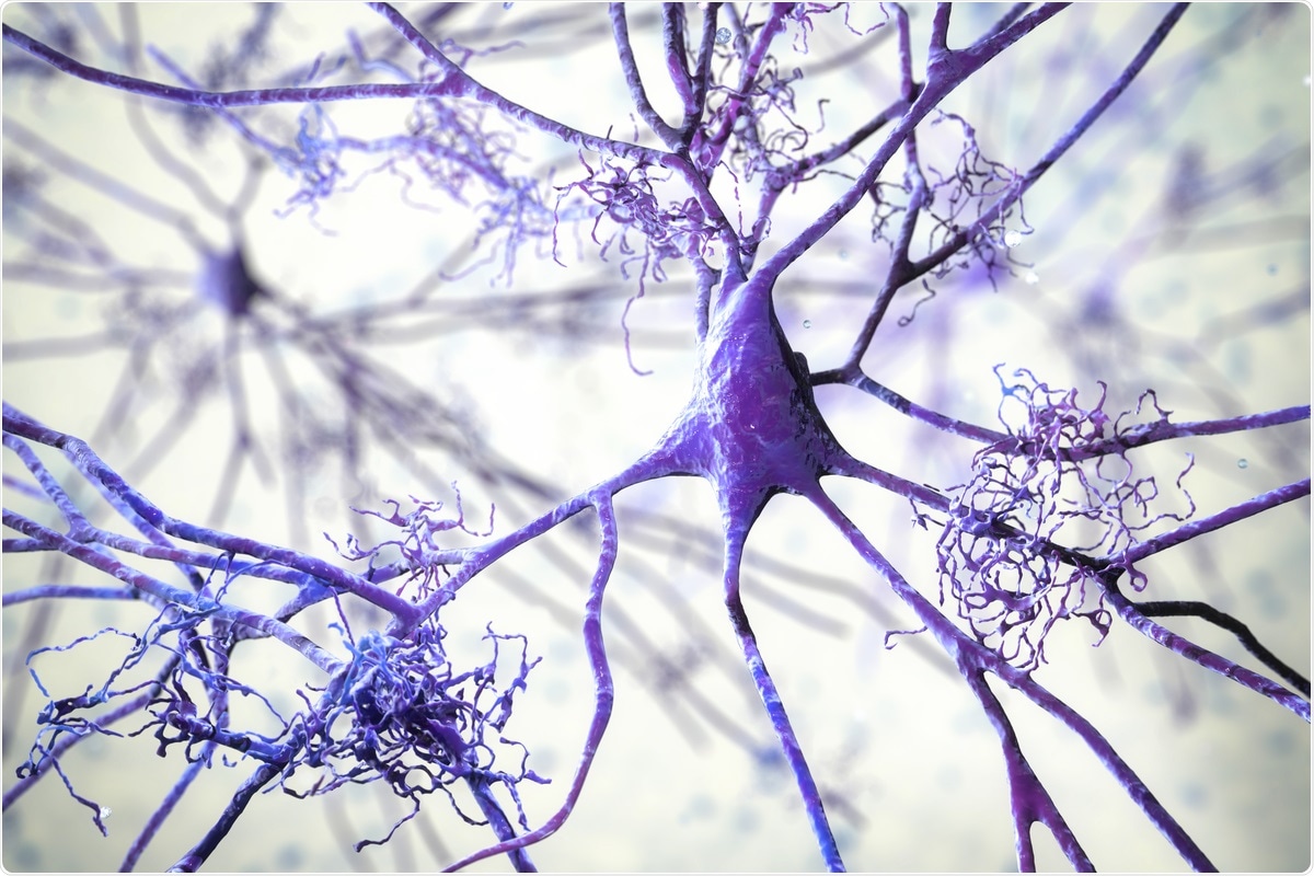 Study: Β-Amyloid Deposits in Young COVID Patients. Image Credit: Kateryna Kon / Shutterstock.com
