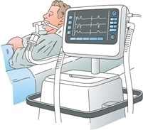 The best methods to improve ventilator reliability and accuracy