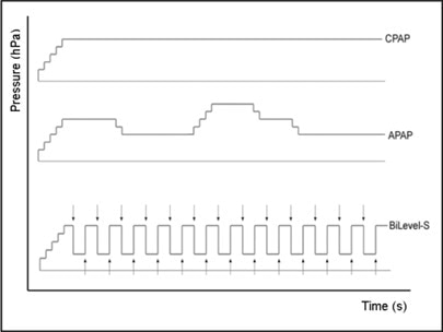 Example of pressure patterns of CPAP vs. APAP vs. BiPAP.