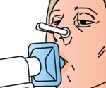 Improving spirometer precision to aid lung condition diagnosis
