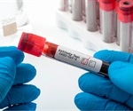 Developing post-vaccination SARS-CoV-2 standard reference sera