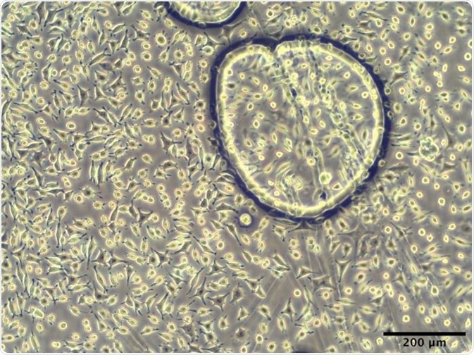 L929 murine fibroblasts adhered to PBS-DLS 50:50 copolyester spin-coated surface after 24 hours of culture.