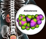 Aldosterone levels undetectably low in hospitalized COVID-19 patients