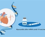 Study evaluates risk estimates of myocarditis and pericarditis from mRNA-1273 and BNT162b2 vaccines