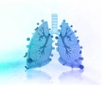 Could oropharyngeal microflora predict COVID-19 patients' need for respiratory support?