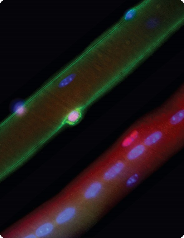 A normal mouse muscle fibre (top left) is contrasted with a muscle fibre from a mouse model of Duchenne muscular dystrophy (bottom right). In normal mice, stem cells (pink) express dystrophin (green)