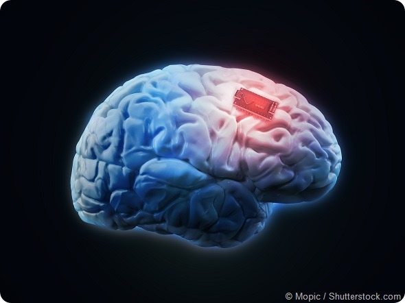 Brain implant concept
