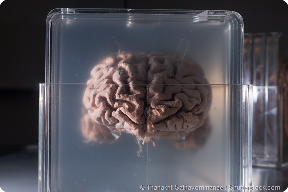 Brain samples preserved in plastic slides, coronal section