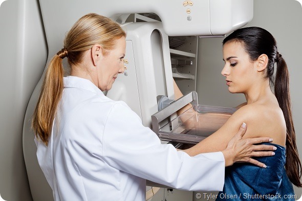 Breast Cancer Mammogram