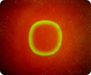 Ring leader. A photograph of Libchaber's experiment shows a ring of motionless E. coli bacteria (green) forming a wave