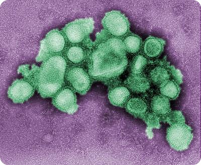 This colorized negative stained transmission electron micrograph (TEM) depicts some of the ultrastructural morphology of the A/CA/4/09 swine flu virus. Credit: CDC/C. S. Goldsmith and A. Balish