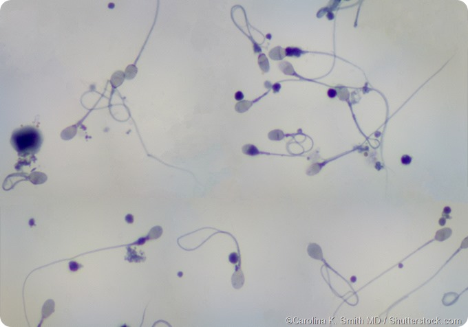Human Sperm and cell bodies
