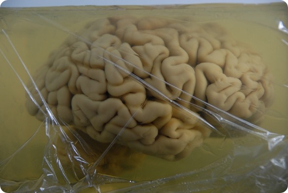 The brain of H.M. is embedded in a gelatin block