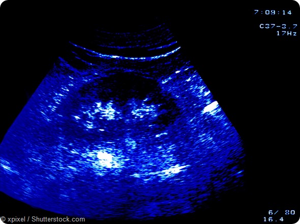 Liver Ultrasound