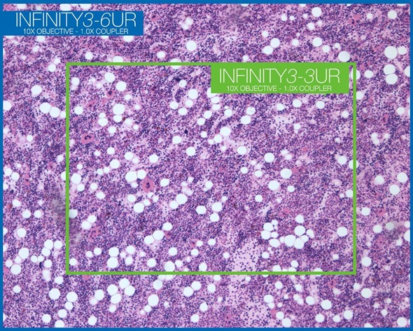 Field of view comparison between Lumenera’s INFINITY3-3URC and INFINITY3-6URC microscopy cameras.