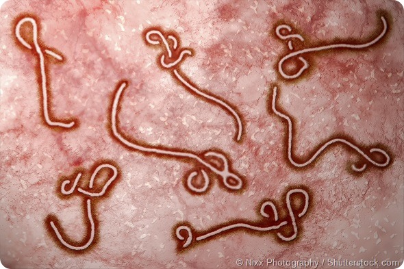 Microscopic view of ebola