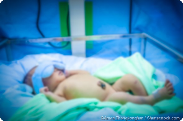 Newborn baby hospital - Arnon Thongkonghan