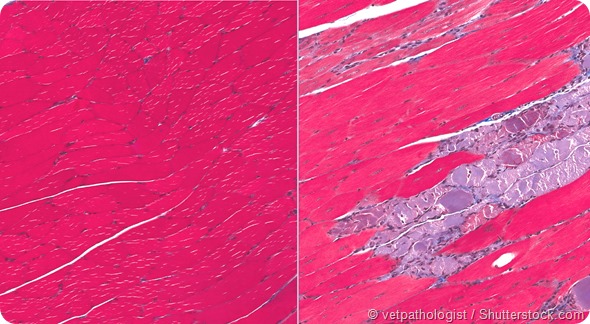 Normal muscle and muscle from Muscular Dystrophy showing degeneration and necrosis of fibers